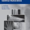 Radiographic Atlas of Skeletal Maturation 1st Edition