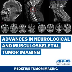 Advances in Neurological and Musculoskeletal Tumor Imaging