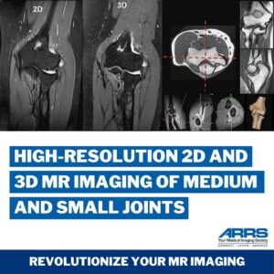 High Resolution 2D and 3D MR Imaging of Medium and Small Joints