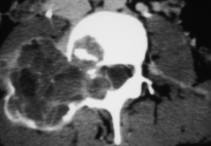 MRI Mastery Series Degenerative Joint Disease DJD 2020