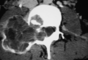 MRI Mastery Series Degenerative Joint Disease DJD 2020