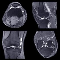 Oakstone NYU Langone Advanced Imaging of the Musculoskeletal System Up Your Game 2023