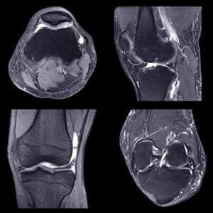 Oakstone NYU Langone Advanced Imaging of the Musculoskeletal System Up Your Game 2023