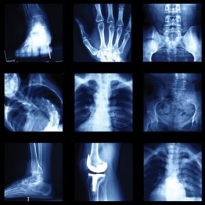 UCSF Imaging Core and Extremities 2024