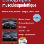 Echographie musculosquelettique - 2e édition - French